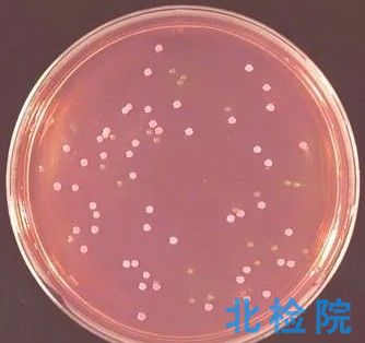 麥康凱瓊脂培養(yǎng)基測(cè)試