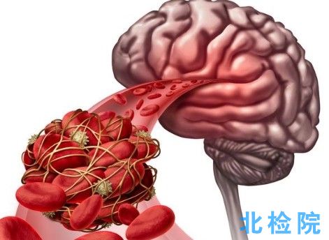 同型半胱氨酸測(cè)定試劑(盒)測(cè)試