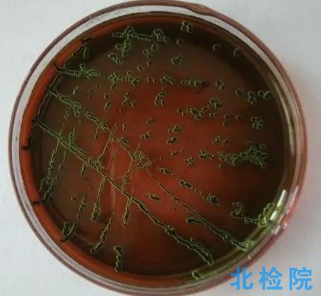 淋球菌瓊脂基礎(chǔ)培養(yǎng)基測試