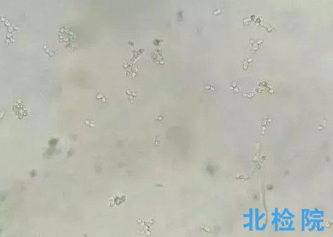 尿干化學(xué)測(cè)試