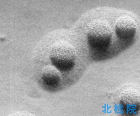 動(dòng)物支原體指標(biāo)檢測(cè)