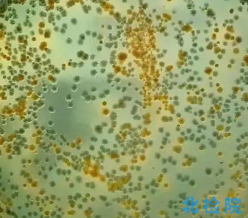 弧菌檢測(cè)