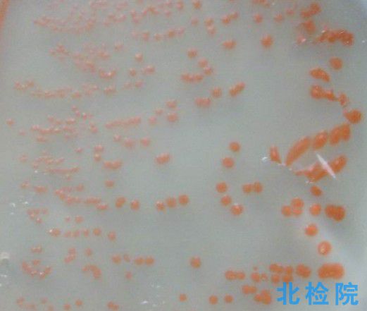 菌株檢測(cè)