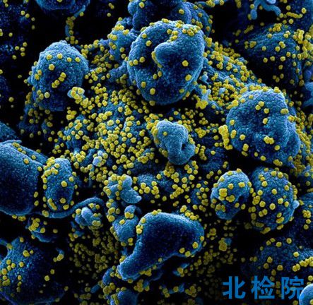 懸浮細(xì)胞病毒
